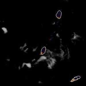 météo tropicale : Image satellite .