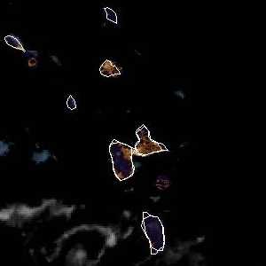 météo tropicale : Image satellite .