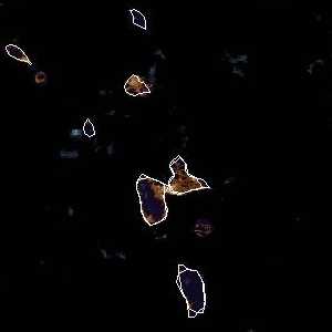 météo tropicale : Image satellite .