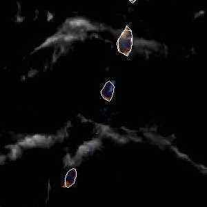 météo tropicale : Image satellite .