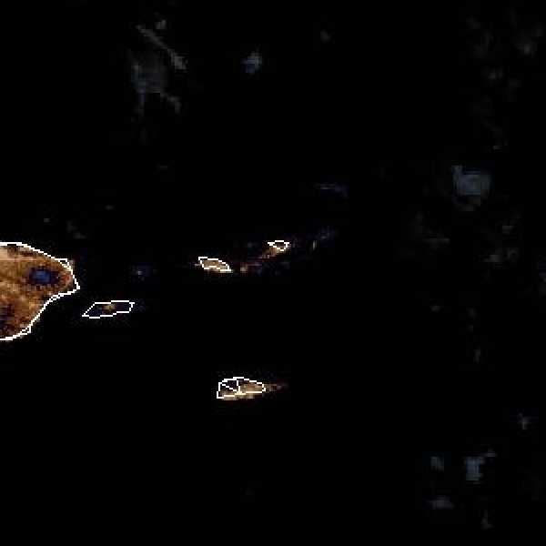 météo tropicale : Image satellite .