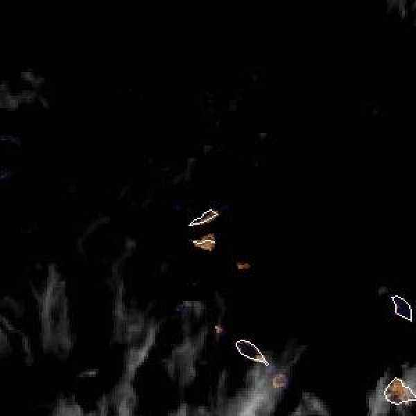 météo tropicale : Image satellite .