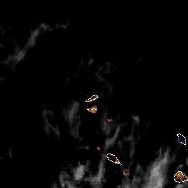 météo tropicale : Image satellite .