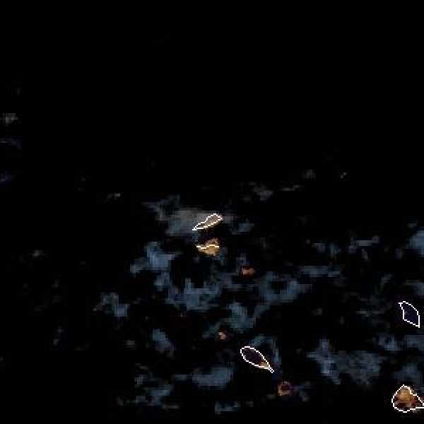 météo tropicale : Image satellite .