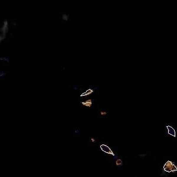 météo tropicale : Image satellite .